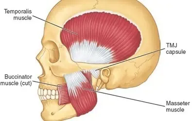 Purentaelimistön anatomia: ohimolihas (m. temporalis), puremalihas (m. masseter) ja leukanivel (TMJ).